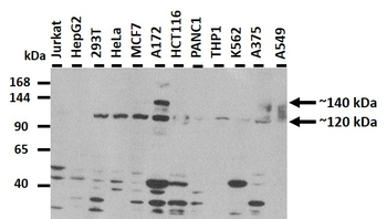 PHLDB1 Rabbit Polyclonal Antibody