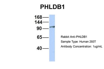 PHLDB1 Rabbit Polyclonal Antibody