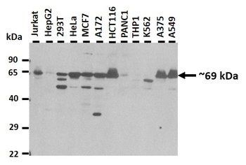 KIAA0892 Rabbit Polyclonal Antibody