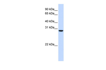 C18orf10 Rabbit Polyclonal Antibody