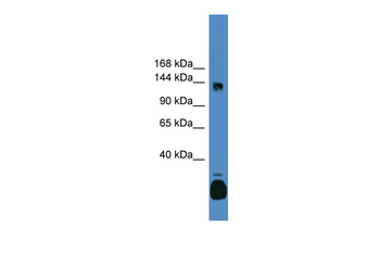 C10orf12 Rabbit Polyclonal Antibody