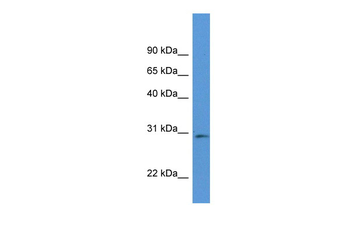 Rpia Rabbit Polyclonal Antibody