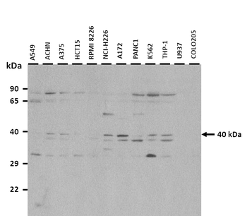 ATP6V0D2 Rabbit Polyclonal Antibody