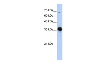 ATP6V0D2 Rabbit Polyclonal Antibody