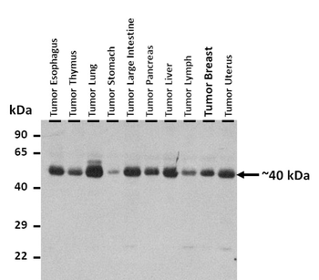 ATP6V0D2 Rabbit Polyclonal Antibody