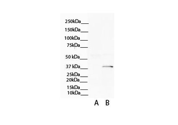 ATP6V0D2 Rabbit Polyclonal Antibody
