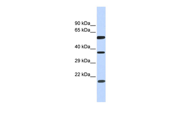 NT5DC1 Rabbit Polyclonal Antibody