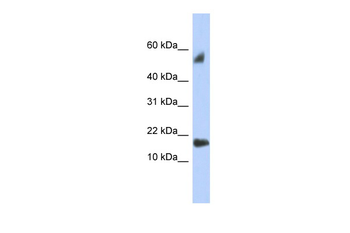 FLJ35767 Rabbit Polyclonal Antibody