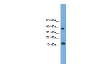 MGAT4D Rabbit Polyclonal Antibody