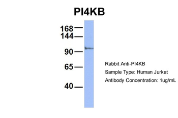 PI4KB Rabbit Polyclonal Antibody