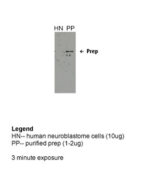 PREP Rabbit Polyclonal Antibody
