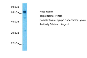 PTPN11 Rabbit Polyclonal Antibody