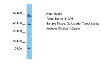 S100A5 Rabbit Polyclonal Antibody
