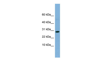RPE Rabbit Polyclonal Antibody