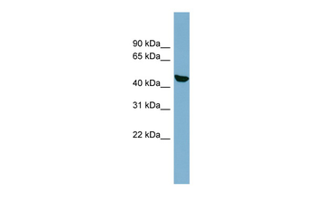C22orf28 Rabbit Polyclonal Antibody
