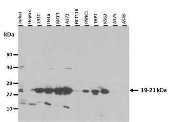POP5 Rabbit Polyclonal Antibody
