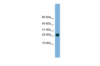POP5 Rabbit Polyclonal Antibody