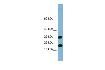 TRAPPC2L Rabbit Polyclonal Antibody