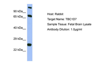 TBC1D7 Rabbit Polyclonal Antibody