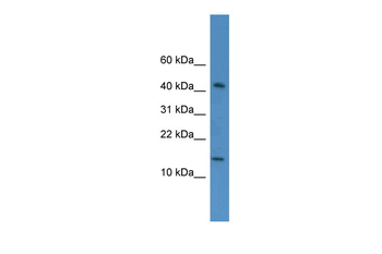 FLJ10490 Rabbit Polyclonal Antibody