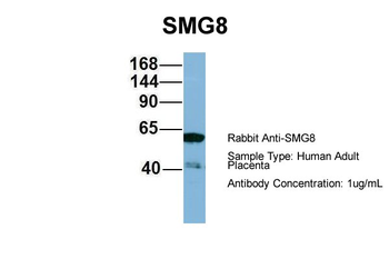 C17orf71 Rabbit Polyclonal Antibody