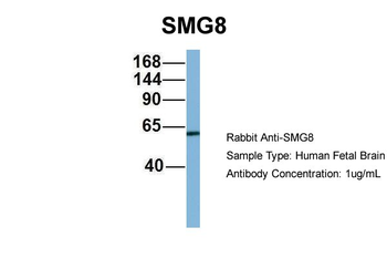 C17orf71 Rabbit Polyclonal Antibody