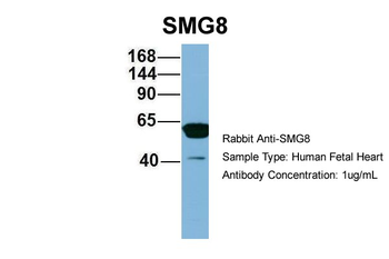 C17orf71 Rabbit Polyclonal Antibody