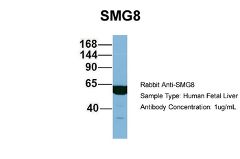 C17orf71 Rabbit Polyclonal Antibody
