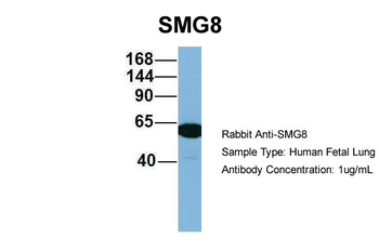 C17orf71 Rabbit Polyclonal Antibody
