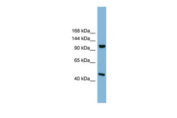 C17orf71 Rabbit Polyclonal Antibody