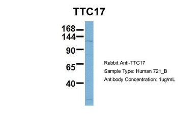 TTC17 Rabbit Polyclonal Antibody