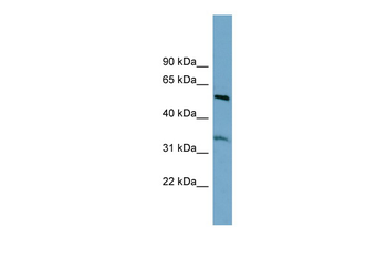 THNSL2 Rabbit Polyclonal Antibody