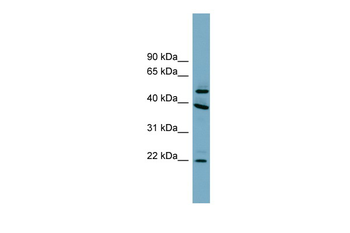 C4orf20 Rabbit Polyclonal Antibody