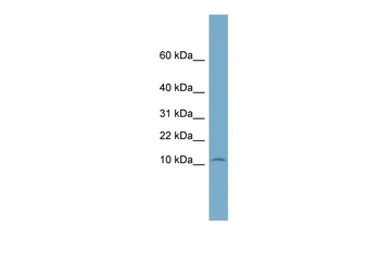NOLA3 Rabbit Polyclonal Antibody