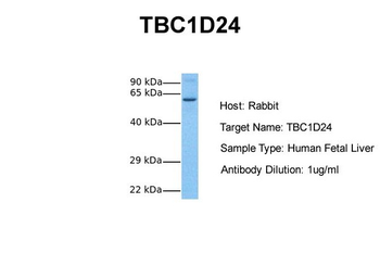 TBC1D24 Rabbit Polyclonal Antibody