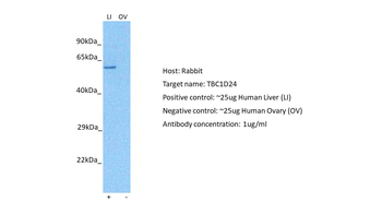 TBC1D24 Rabbit Polyclonal Antibody