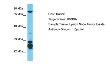 UVSSA Rabbit Polyclonal Antibody