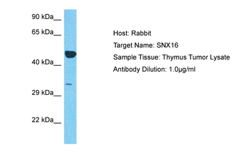 SNX16 Rabbit Polyclonal Antibody