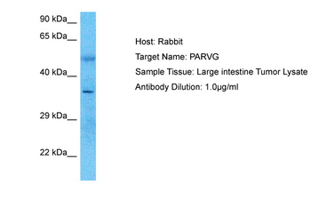 PARVG Rabbit Polyclonal Antibody