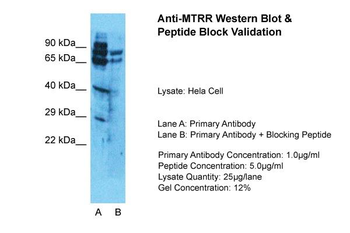 MTRR Rabbit Polyclonal Antibody