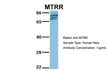 MTRR Rabbit Polyclonal Antibody