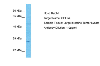 CELA2A Rabbit Polyclonal Antibody