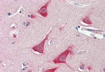 TUB Rabbit Polyclonal Antibody