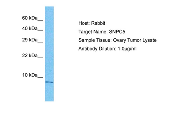SNAPC5 Rabbit Polyclonal Antibody