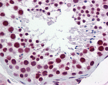 HNRPH1 Rabbit Polyclonal Antibody