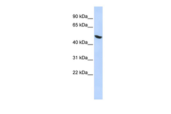 HNRPH1 Rabbit Polyclonal Antibody