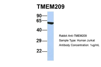 FLJ14803 Rabbit Polyclonal Antibody