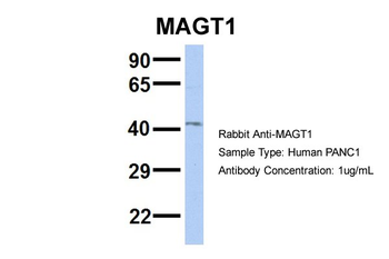 RP11-217H1.1 Rabbit Polyclonal Antibody
