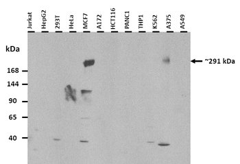 USP9Y Rabbit Polyclonal Antibody