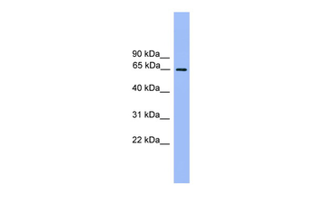 UBQLN2 Rabbit Polyclonal Antibody